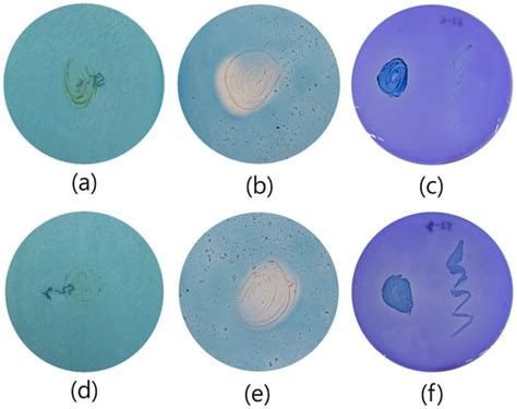 Two Novel Bacterial Species Rhodanobacter Lycopersici Sp Nov And