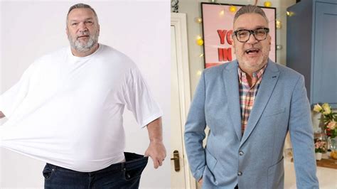 Razor Ruddocks Weight Loss Pictures Did He Receive Surgery How Much