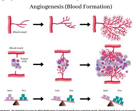Pdf Angiogenesis In Breast Cancer Progression Diagnosis And