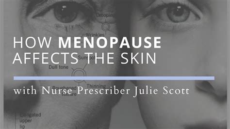 How Menopause Affects The Skin And What You Can Do About It Youtube