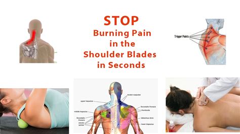 Shoulder blade pain diagnosis and treatment options. Stop Burning Pain in Shoulder Blades in Seconds (Simple ...
