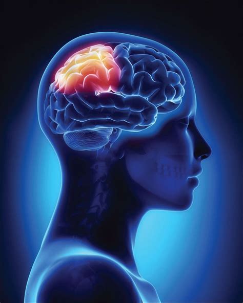 Stroke Connection Summer 2018 When Stroke Affects The Parietal Lobe Body Anatomy Brain