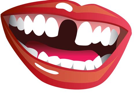 Free Missing Teeth Cliparts Download Free Missing Teeth Cliparts Png