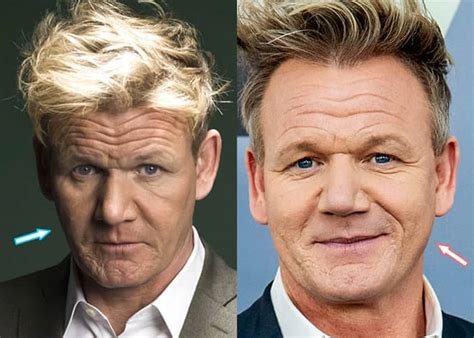 Gordon Ramsay Before And After