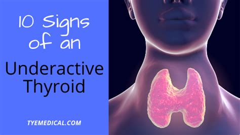 10 Signs Of Hypothyroidism Underactive Thyroid Tye Medical