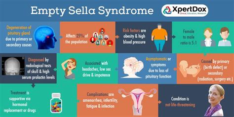 Empty Sella Syndrome Is A Condition That Involves The Sella Turcica A