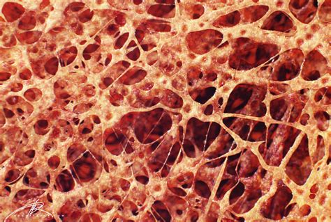 Browse 4,244 bone cross section stock photos and images available, or search for human bone cross section to find more great stock photos and. "Bone Cross Section" for Radius Digital Science on Behance