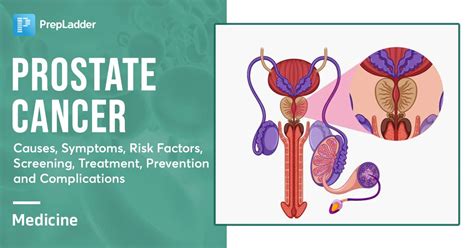 Prostate Cancer Causes Symptoms Risk Factors Screening Treatment Prevention And Complications