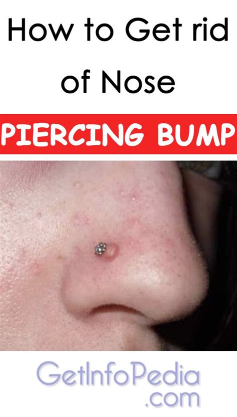 How To Get Rid Of Nose Piercing Bump Nose Piercing Nose Piercing