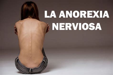 Anorexia Nerviosa Sntomas Causas Y Tratamiento Mejor