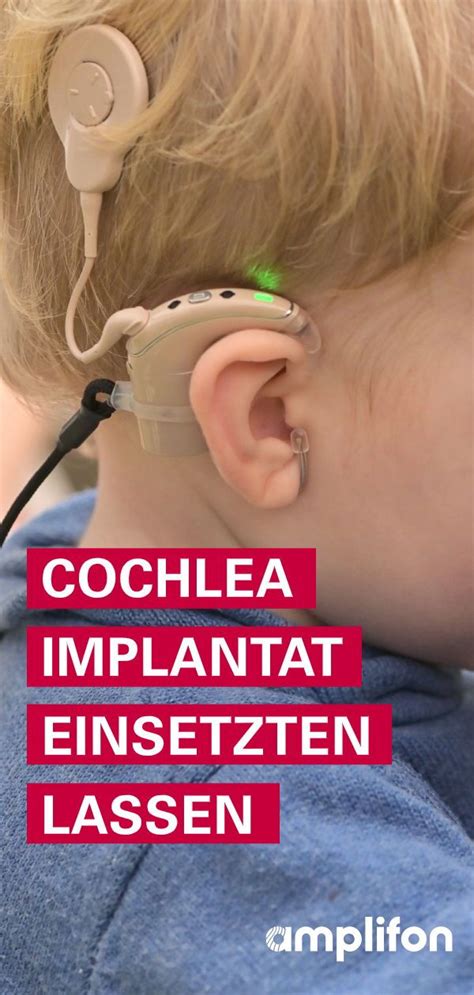 Sie überlegen Ob Sie Sich Ein Cochlea Implantat Einsetzten Lassen