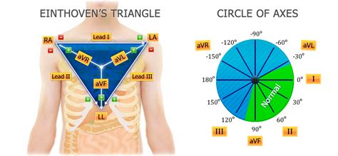 A Quick Guide To Ecg Ivline