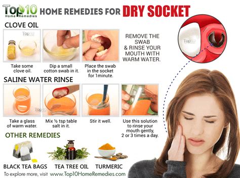People should take the advice of their dentist or surgeon on how to aid recovery. Home Remedies for Dry Socket | Top 10 Home Remedies