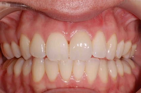 Preventive Dentistry Clarinda Clinic