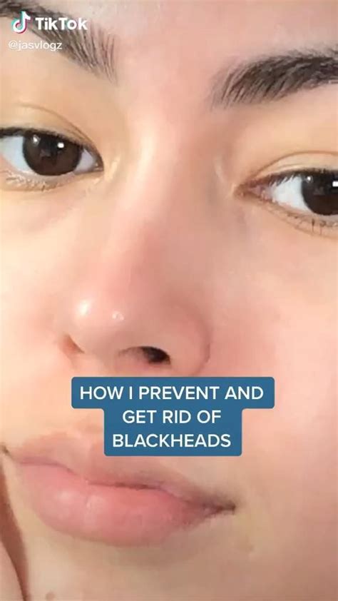 How To Get Rid Of Blackheads By Eyes Howtoremvo