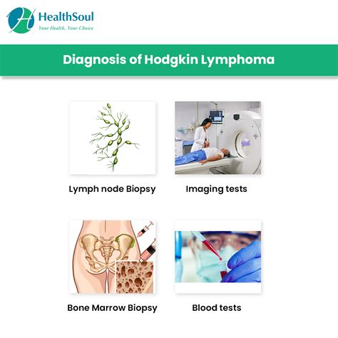 Hodgkin Lymphoma Symptoms And Treatment Healthsoul