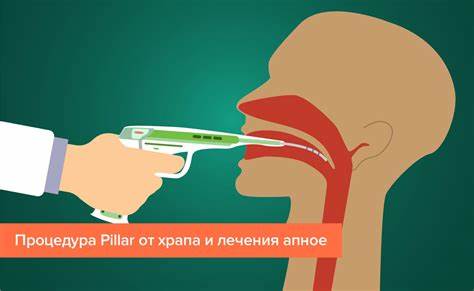 Диета при апноэ сна Апноэ сна причины лечение Апноэ сна причины лечение Диета при апноэ сна