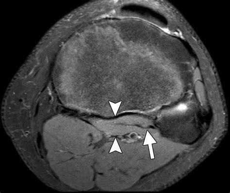 Comprehensive Review Of The Anatomy Function And Imaging Of The