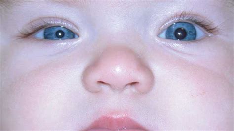 Division Of Ophthalmology News And Updates Childrens Hospital Of