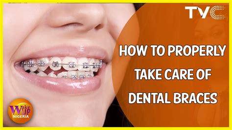 How To Properly Take Care Of Dental Braces Youtube
