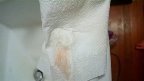 Implantation Bleeding Warning Pictures Attached Trying For A Baby