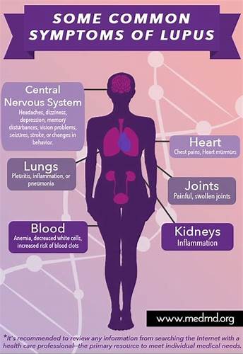Диета при системная красная волчанка Красная Волчанка Диета — Похудение Диета Правильное Питание Красная Волчанка Диета — Похудение Диета Правильное Питание Диета при системная красная волчанка