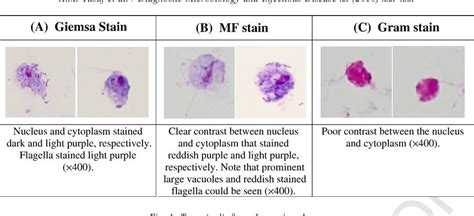 Pdf Modified Fields Staining A Rapid Stain For Trichomonas
