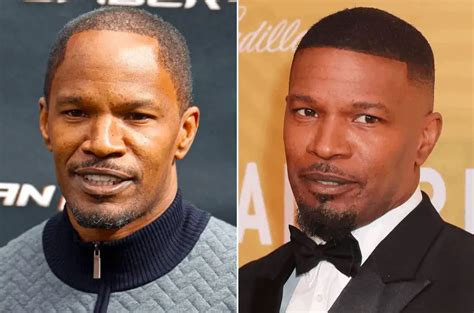 Jamie Foxx Hairline Surgery Before And After Photos