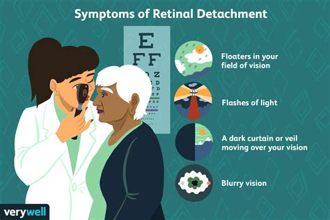 Detached Retina Signs Symptoms And Complications