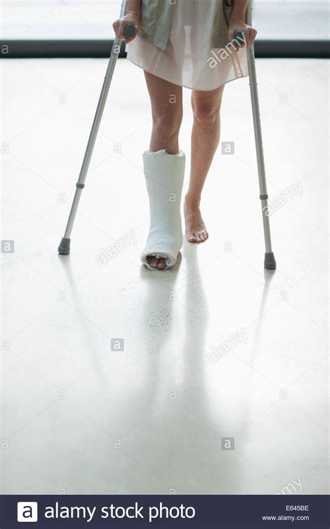 Leg Cast Crutches Stock Photos And Leg Cast Crutches Stock Images Alamy