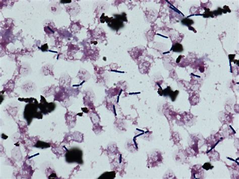 However, with older cultures the gram stain reaction can be variable and also cells may appear spheroidal. グラム陽性桿菌: GPR | グラム染色: Gram Stain