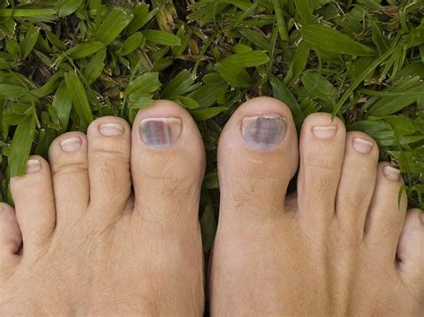 Check spelling or type a new query. Madang - Ples Bilong Mi » Blog Archive » Yoga Toes