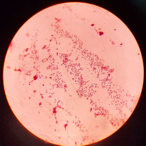 Tinción de Gram Microorganismos Bioquímica Microbiología