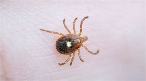 Red Meat Allergy Caused By Ticks Is An Emerging Public Health Concern