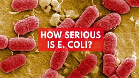 What You Need To Know About E Coli And Outbreaks Youtube