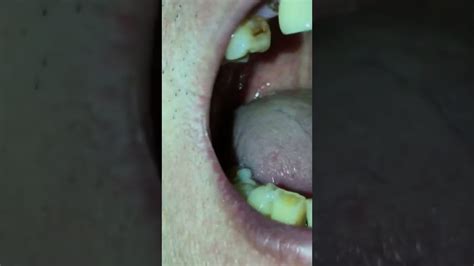 Touch My Dads Uvula Youtube
