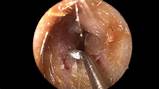 Ear Wax Doctor Images