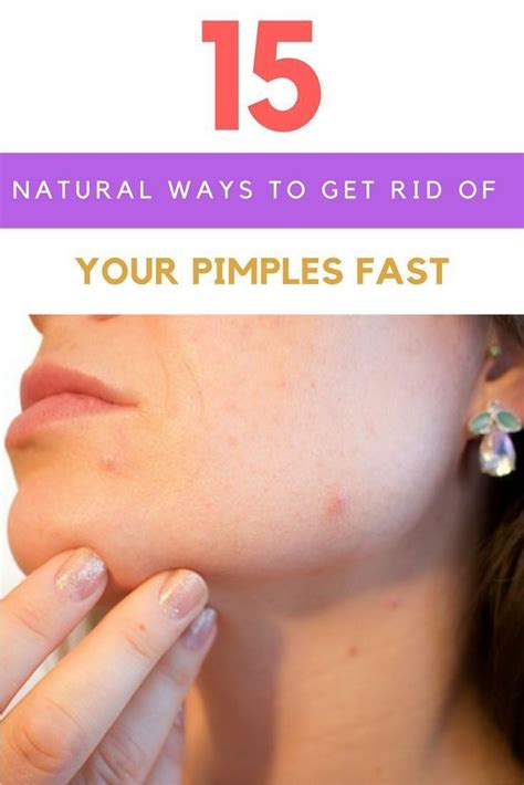 Pin On How To Get Rid Of Acne Scars And Spots Fast
