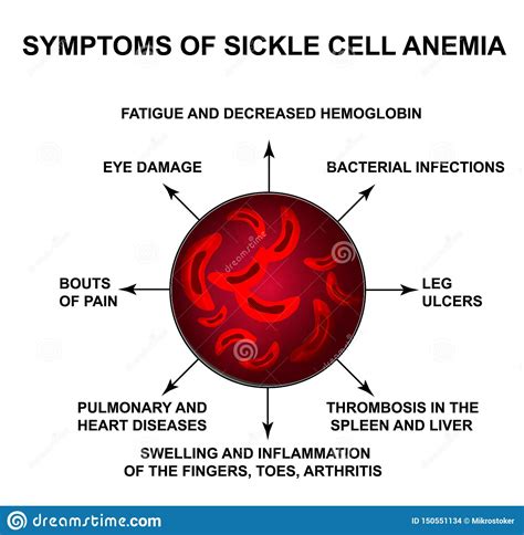 Pain and fatigue are prominent symptoms of this disorder. Symptoms Of Sickle Cell Anemia. World Sickle Cell Anemia ...