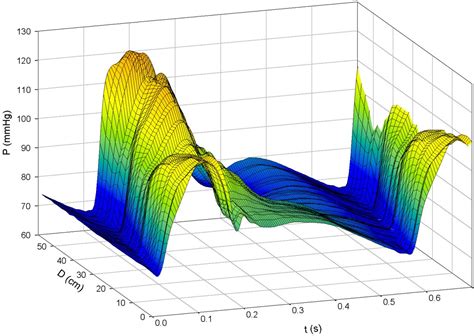 Wave intensity analysis