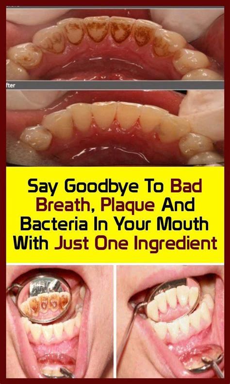 say goodbye to bad breath plaque and bacteria in your mouth with just one ingredient bad