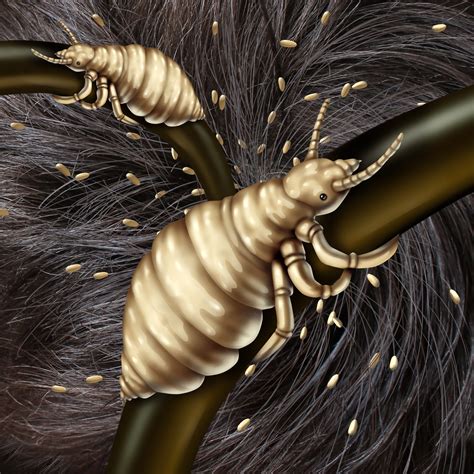 Head Lice And The Other Types Lice Clinics Of Texas