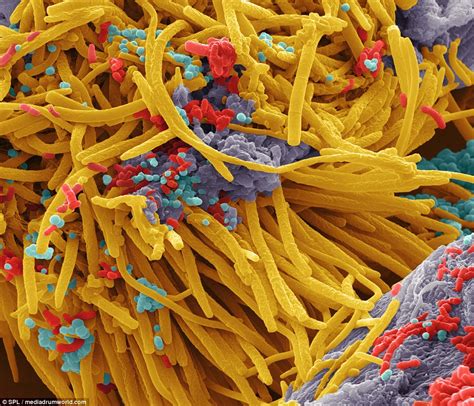 Close Up Images Of Bacteria That Live Inside Our Mouths Daily Mail Online