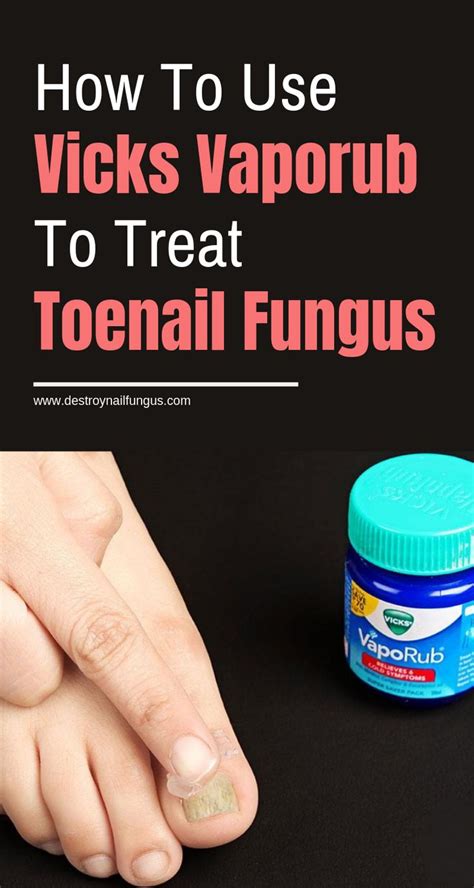 How To Use Vicks Vaporub To Treat Toenail Fungus Nail Fungus Cure