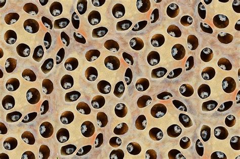 I have it myself, so making this quiz was suuper hard. What is Trypophobia? - WorldAtlas.com