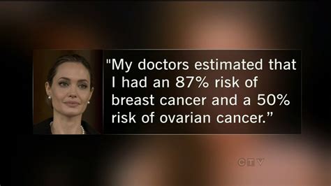 Local Doctors See Spike In Calls About Breast Cancer Test Ctv