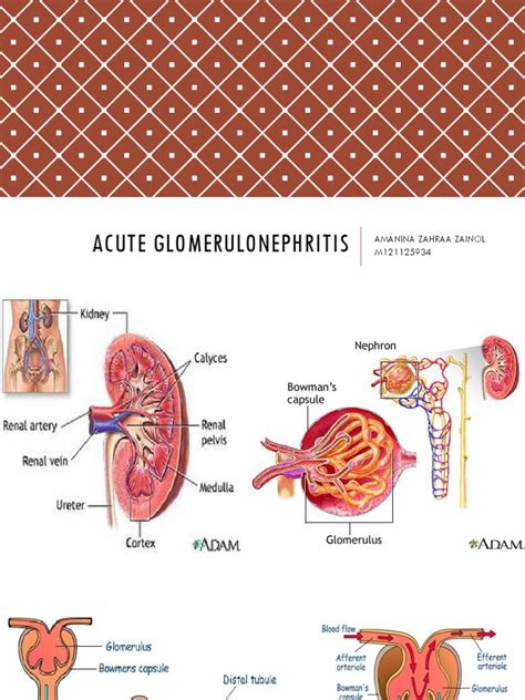 Acute Glomerulonephritis Medical Specialties Diseases And Disorders
