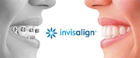 Affordable Invisalign Orthodontist And Teeth Straightening In Nyc