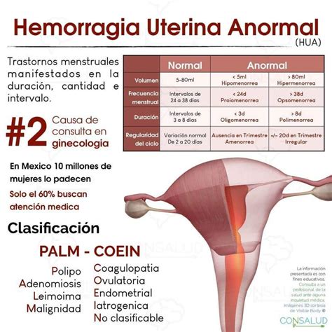 Hemorragia Uterina IAM Obstetricia Gineco Obstetricia Estudiante De Medicina