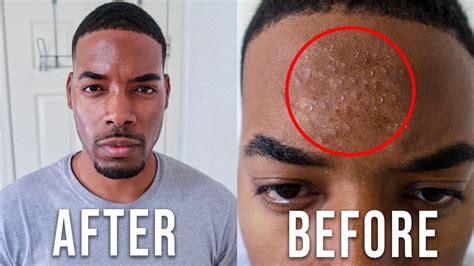the best black men s skin care routine for clear skin curlystyly